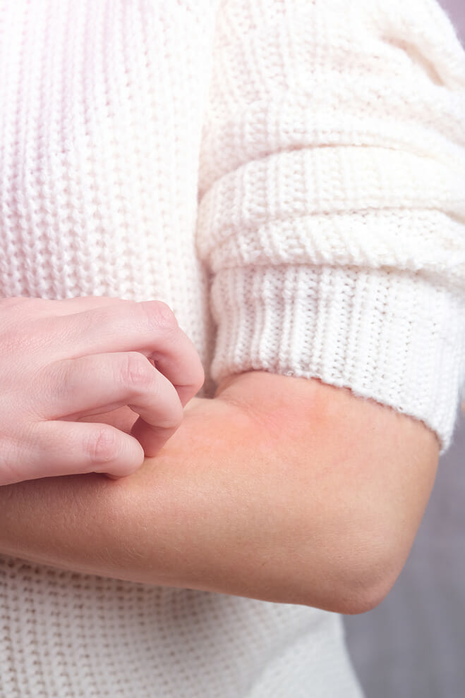 Close-up of an arm scratching skin under a white knitted wool sweater